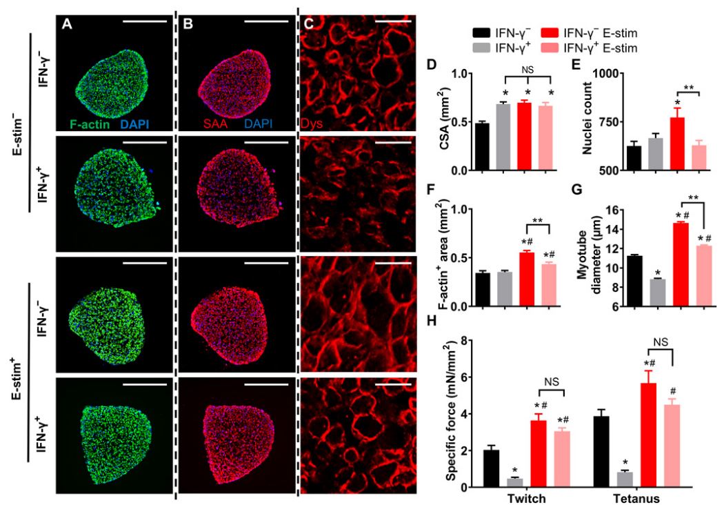 E-刺激可防止IFN-γ引起的肌管長度，肌小節豐度和收縮蛋白表達減少