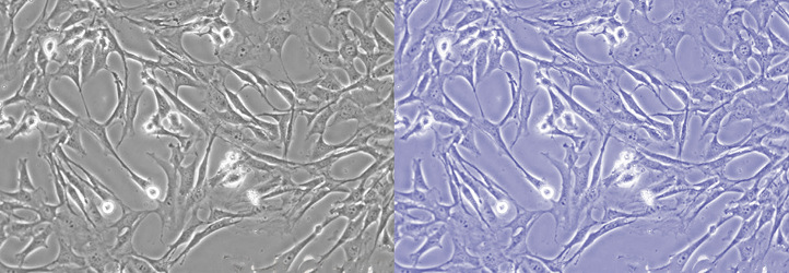 Leica DM IL LED倒置熒光顯微鏡細胞圖像色溫調整效果對比.jpg